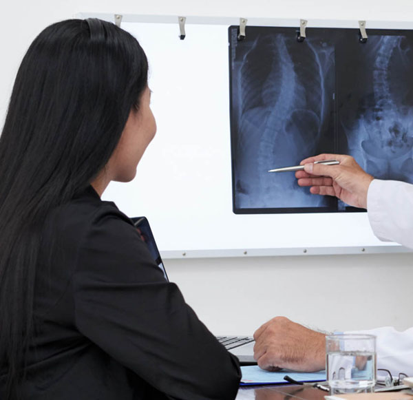 Κύφωση - Σκολίωση